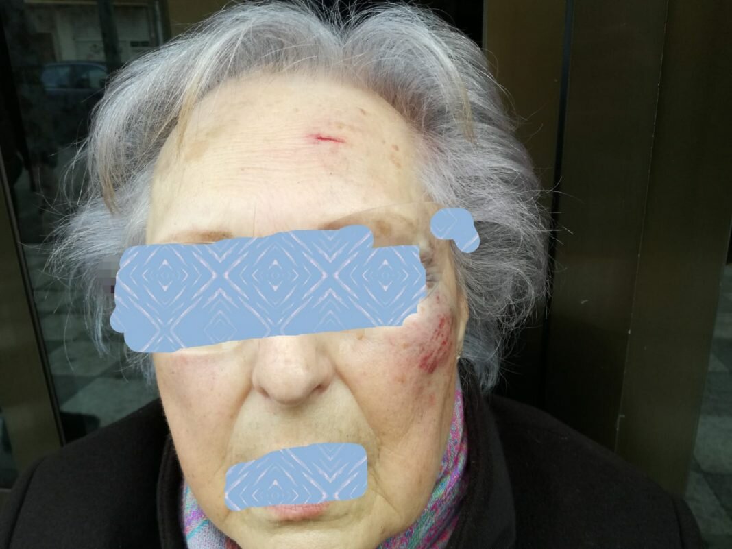 UCIN ALBACETE reclama un plan integral de rehabilitación de aceras ante el creciente aumento de caídas por el mal estado de éstas.